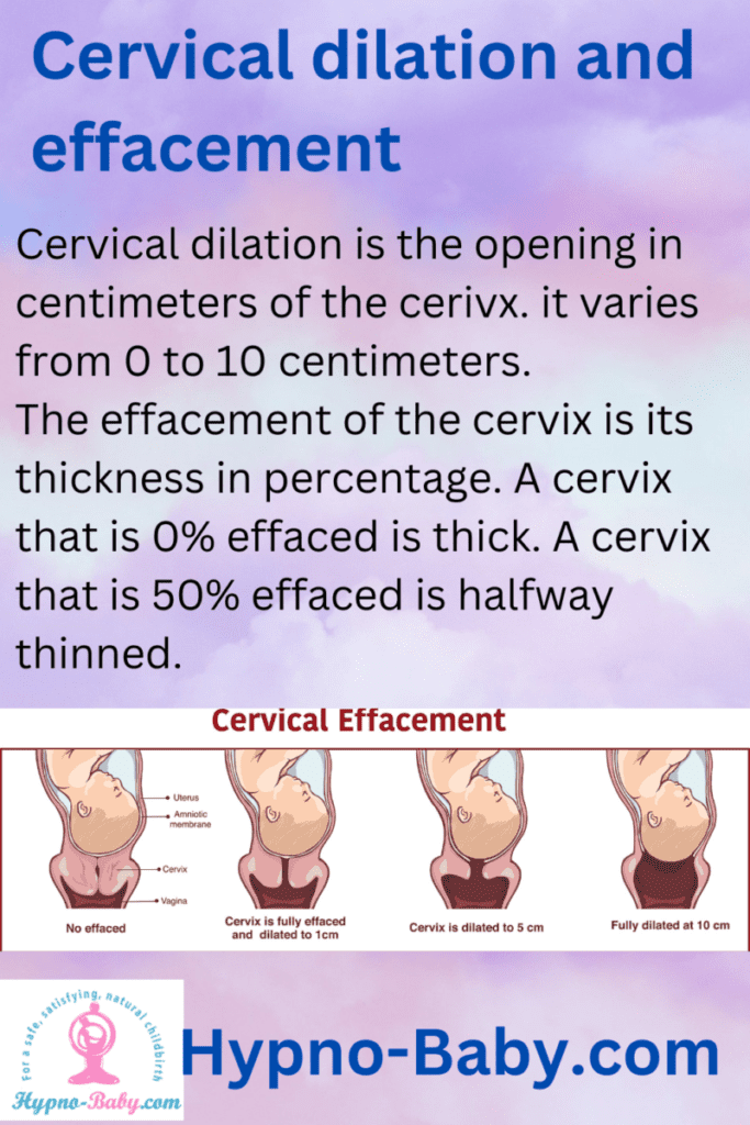 cervical dilation and effacement