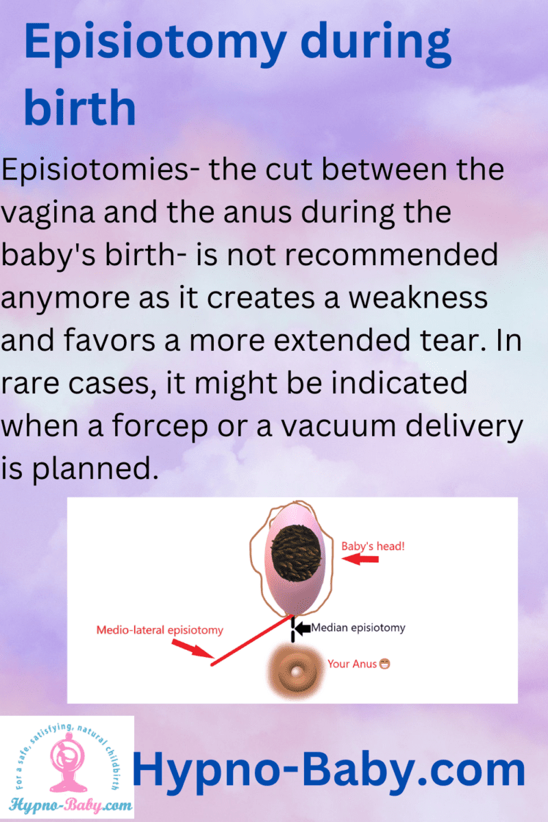 episiotomy: pros and cons